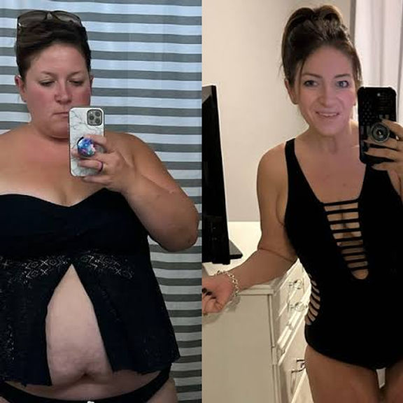 Semaglutide - Weight Loss Injections 10mg